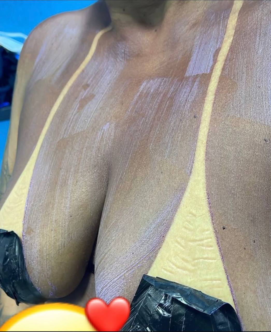 Resultado de bronzeamento Carla Bronze